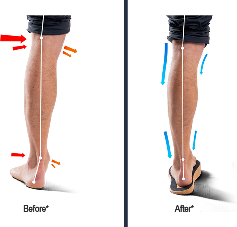 SoleSteps®
