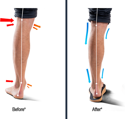 SoleSteps®